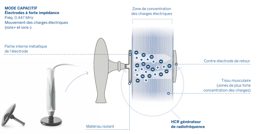 HCR 1002 Human Tecar